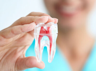 endodonti-kanal-tedavisi
